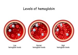 Pregnant Women & Hemoglobin Levels