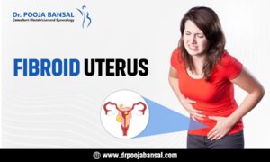 Why are you struggling with fibroid uterus?