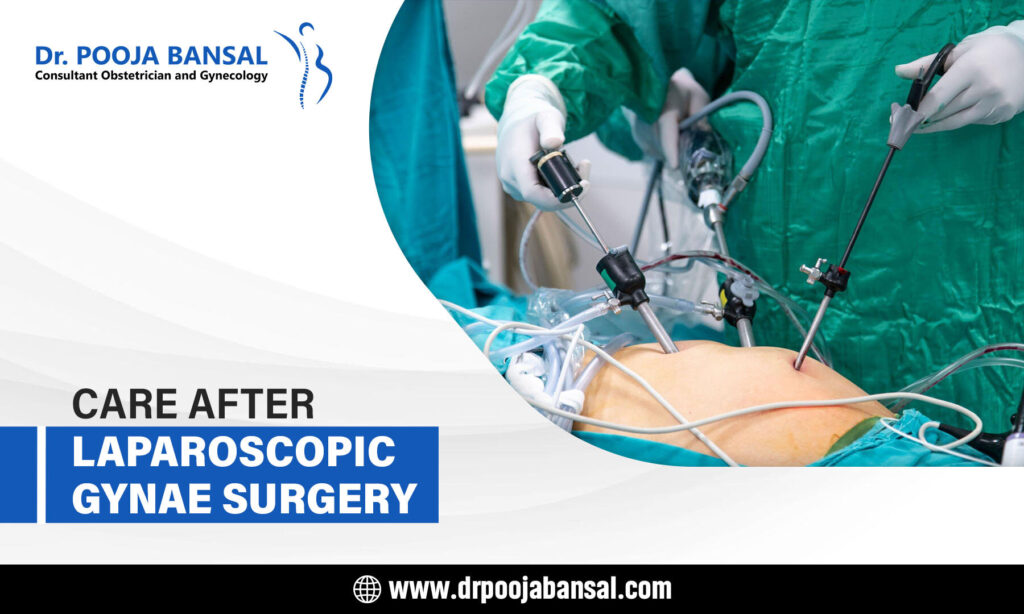 care after laparoscopic gynac surgery